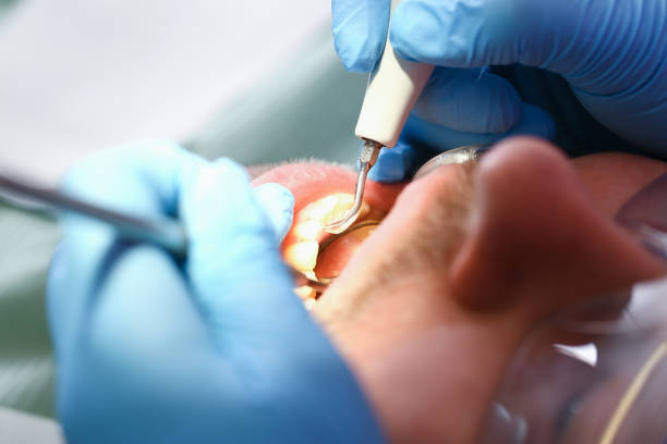 Best Walk-In Emergency Dental Services in Arnold, CA