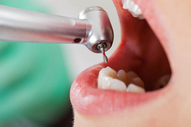 Best Emergency Orthodontic Repairs in Arnold, CA
